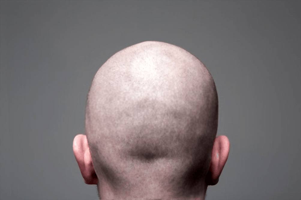 shaved head back