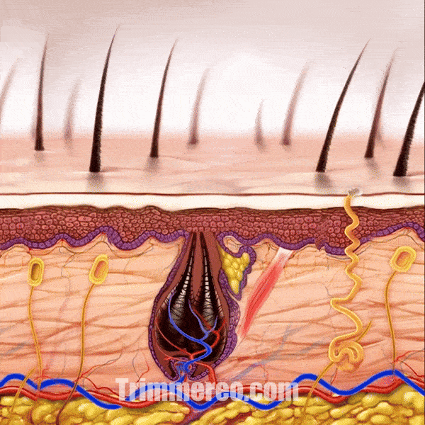 ingrown hair