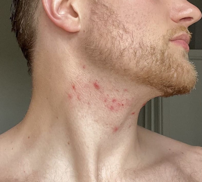 razor cuts
